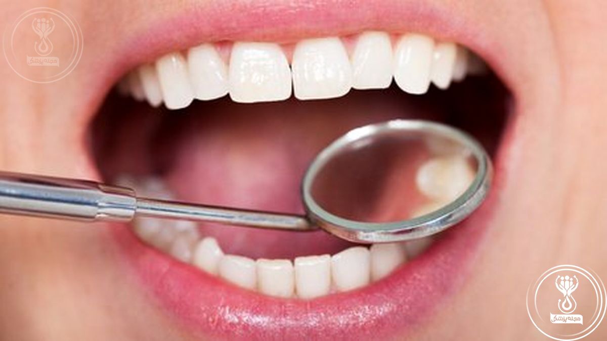 درمان حساسیت دندانی