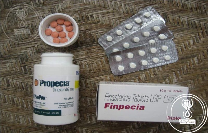 فیناستراید (Propecia) دارویی برای درمان ریزش مو مردان