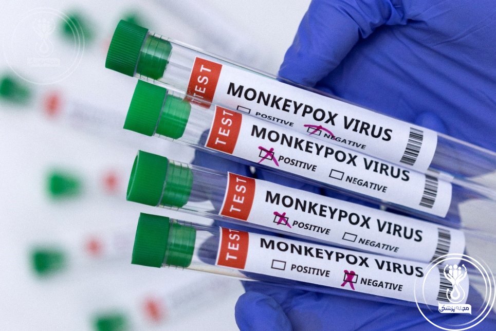 انتقال و آلوده شدن به ویروس آبله میمون