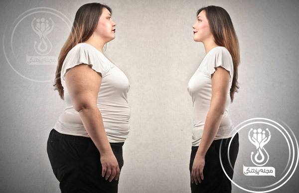 کنترل چاقی درمان موثر کبد چرب