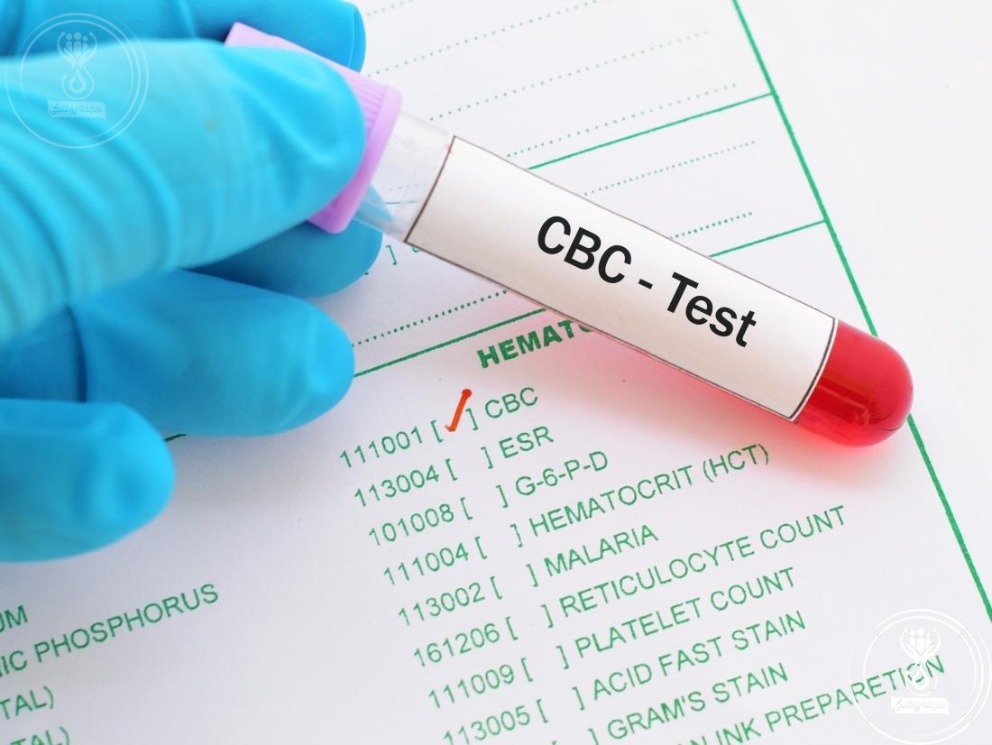 آزمایش CBC؛ شمارش کامل سلول‌های خونی