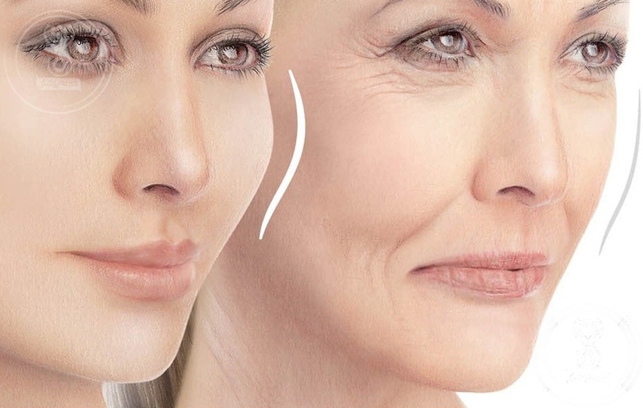 درمان موثر برای حجم دادن صورت