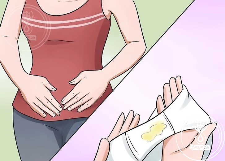 افرایش ترشحات واژن؛ نشانه رایج بارداری