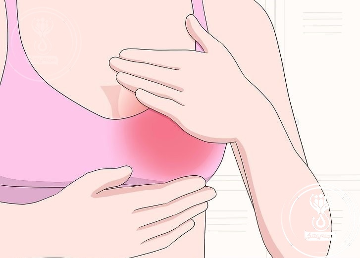 تورم و خارش سینه از علائم بارداری در هفته های اول 